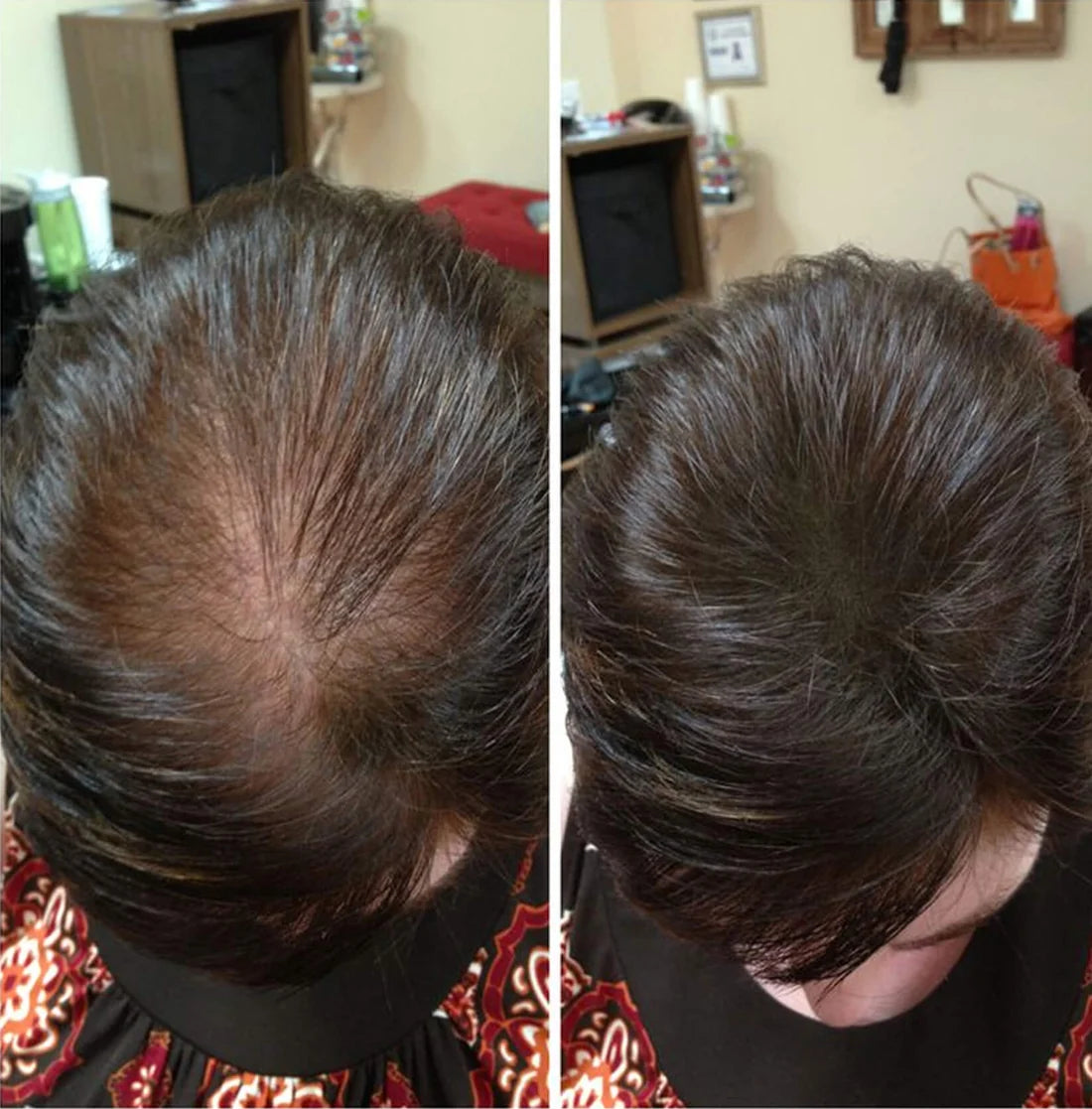 Woman's Essence: Las vitaminas naturales para un cabello fuerte, abundante y lleno de vida.