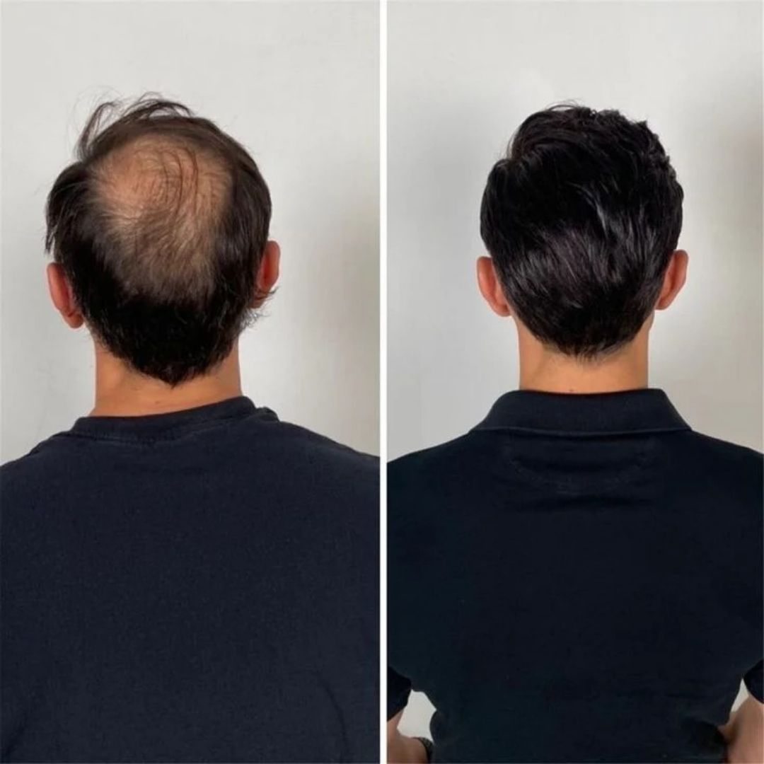 Aceite de Batana Capilar – Nutrición profunda para un cabello más fuerte y con mejor apariencia