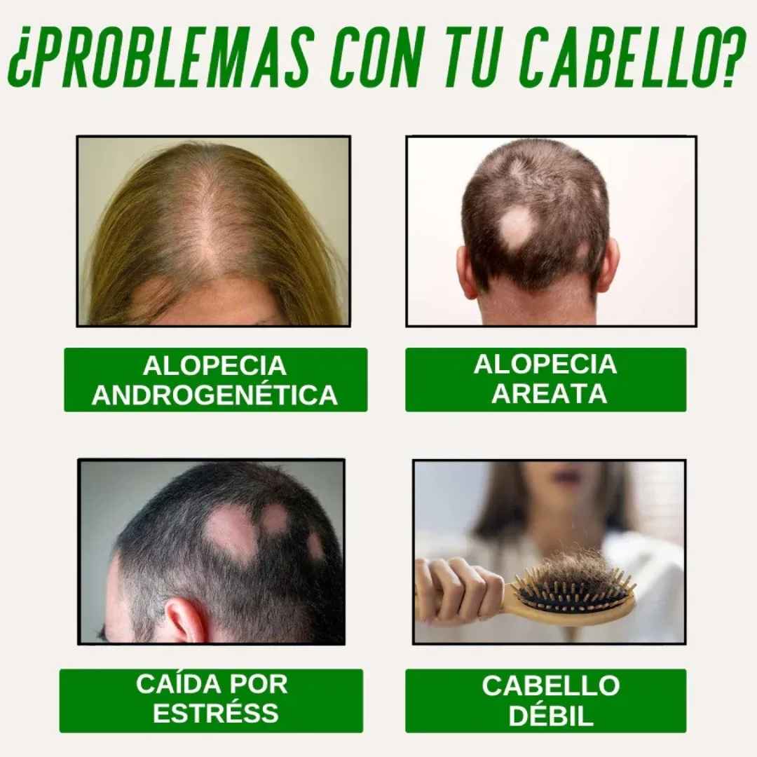 Aceite de Batana Capilar – Nutrición profunda para un cabello más fuerte y con mejor apariencia