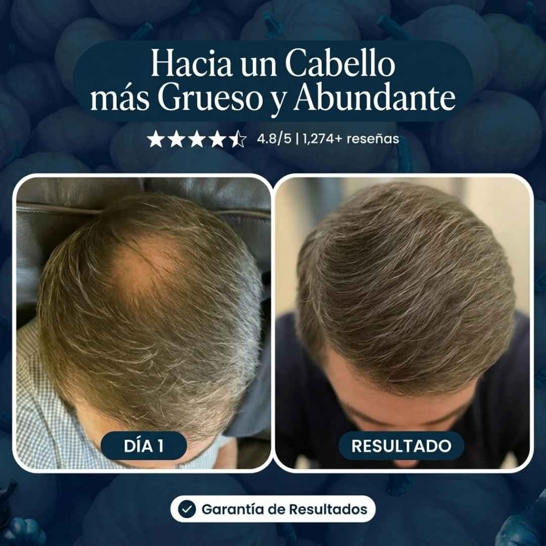 Shampo Excalvo- Màs Densidad, Màs Fuerza y Una Apariencia Visiblemente  Màs Abudante