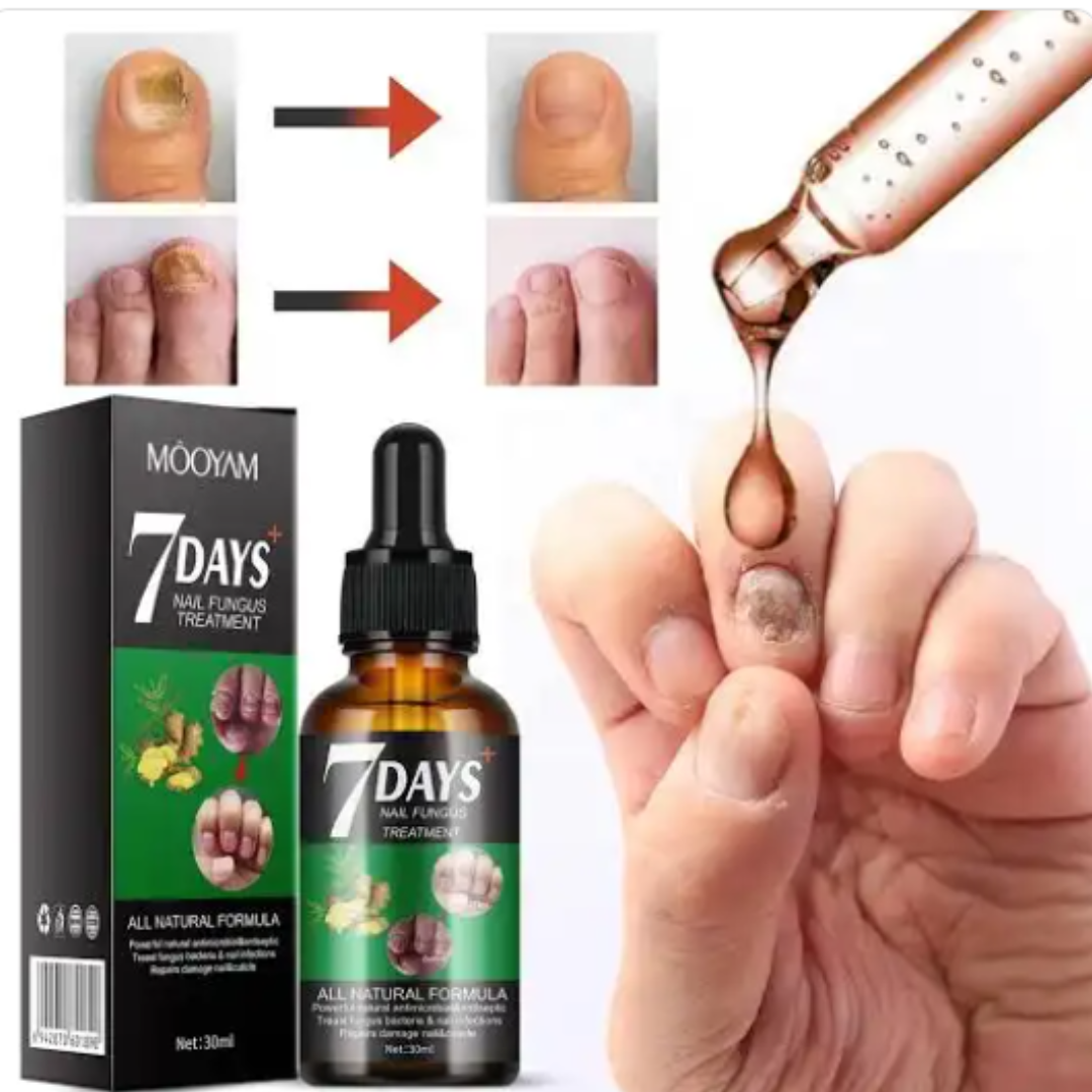 Fungus 7 dias Deja de esconder tus uñas y dales el cuidado que merecen.