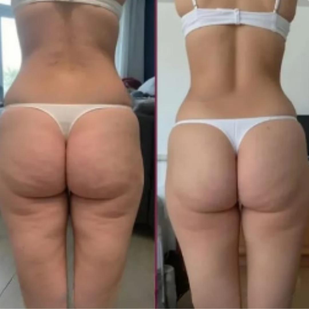 CANDELA CREAM – Firmeza visible, piel renovada y cuidado profundo desde la primera aplicación
