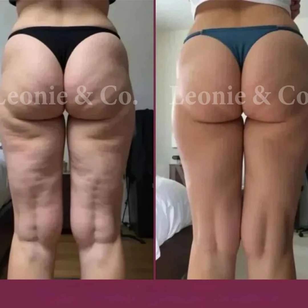 CANDELA CREAM – Firmeza visible, piel renovada y cuidado profundo desde la primera aplicación