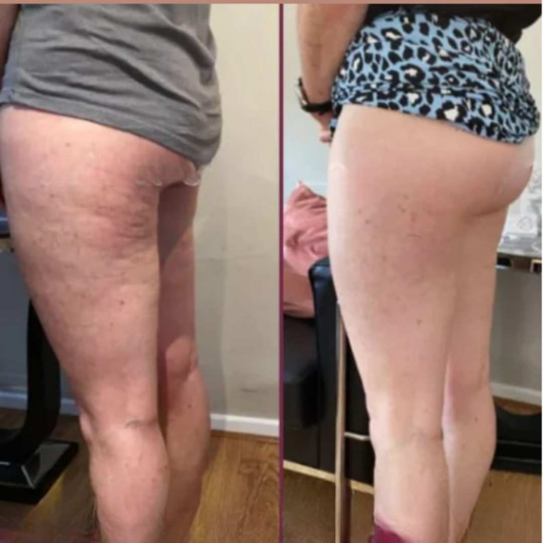 CANDELA CREAM – Firmeza visible, piel renovada y cuidado profundo desde la primera aplicación