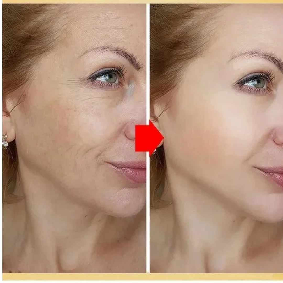Crema Facial Qinglin 6-en-1: Piel firme, suave y sin arrugas.