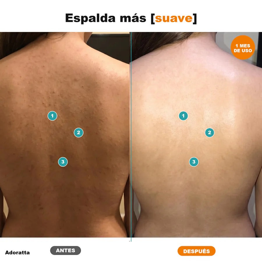 Exfoliante de Naranja: Renueva y unifica el tono de tu piel.