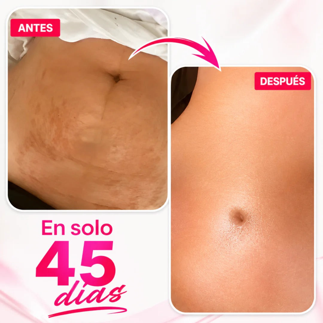 CANDELA CREAM – Firmeza visible, piel renovada y cuidado profundo desde la primera aplicación