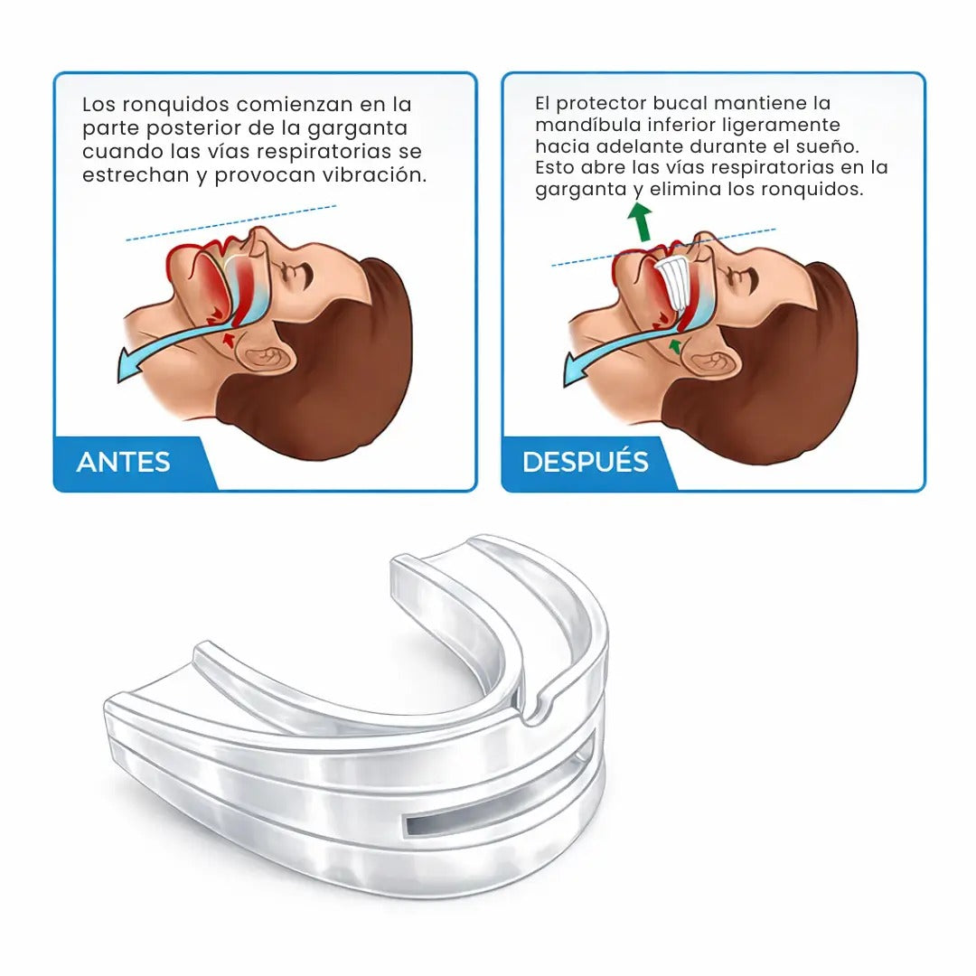 SleepGuard®️: Protector Bucal Nocturno contra Ronquidos y Bruxismo 🦷