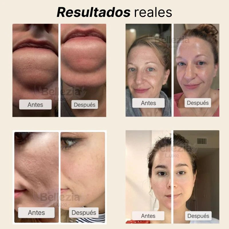 Dr.Melaxin White Rice: ¡Rocía y ve el cambio!