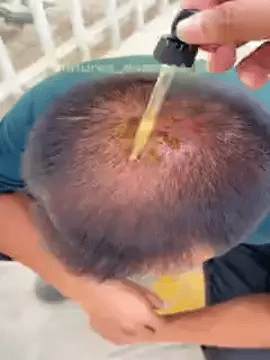 Encabezado