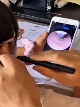 Limpieza de oídos inteligente con tecnología avanzada – WaxClean™